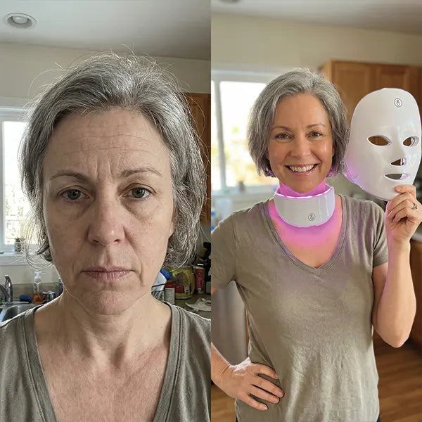 Before/After - Françoise