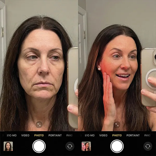 Before/After - Nathalie