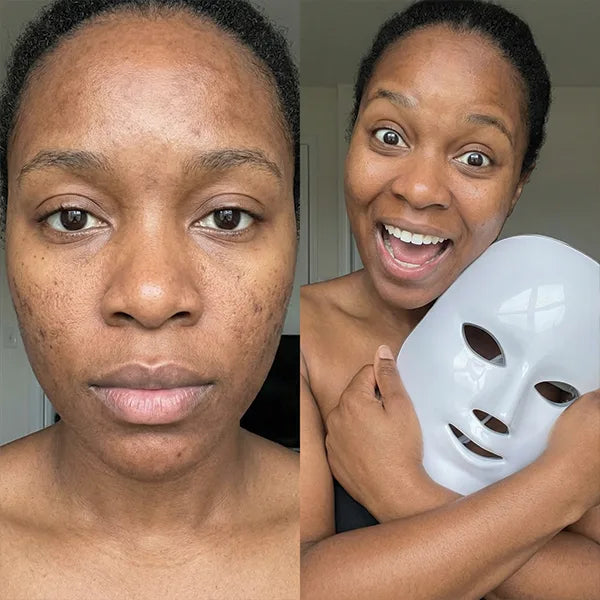 Before/After - Amina