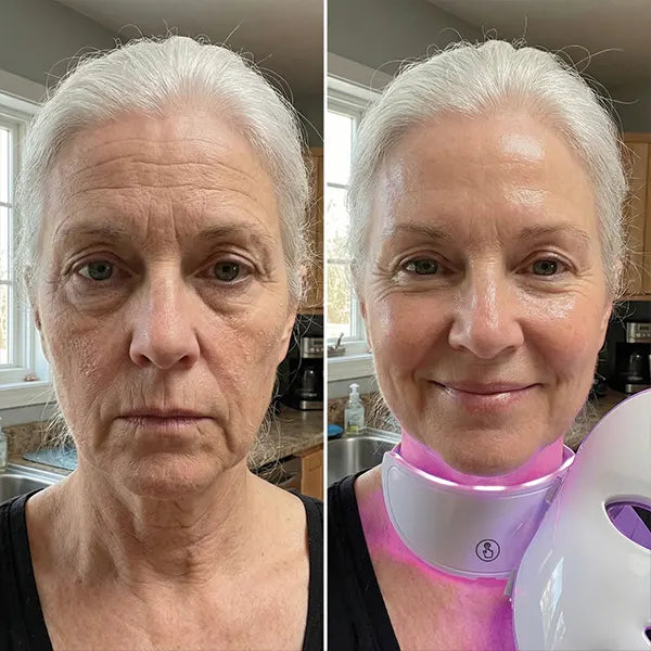 Before/After - Catherine