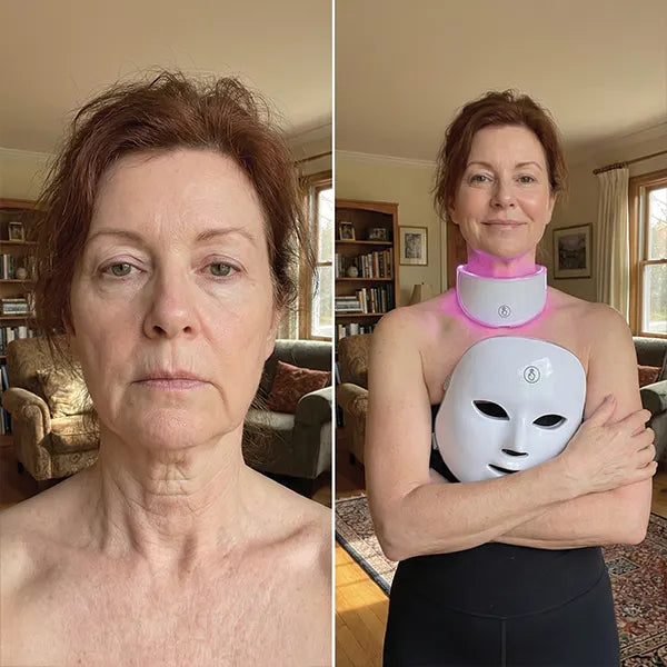 Before/After - Catherine