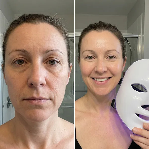 Before/After - Catherine