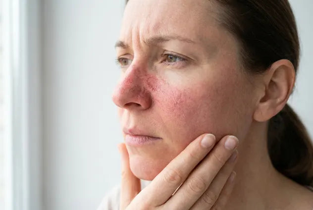 Rougeurs et peau sensible