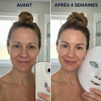 Jovëa NanoÉclat Duo - Rajeunir en 30J Sans Aiguilles